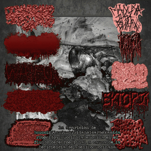 Blenncardichromodacryexgenitohaemgene : La Aparicion de 5succinilamino4imidazolcarboxamida Ribósidoy Succiniladenosina en el Fluido Cerebroe